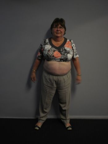 Bernadette Boyd (before)