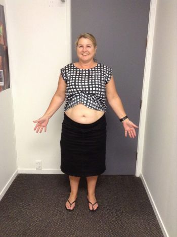 Jannette W. (before)