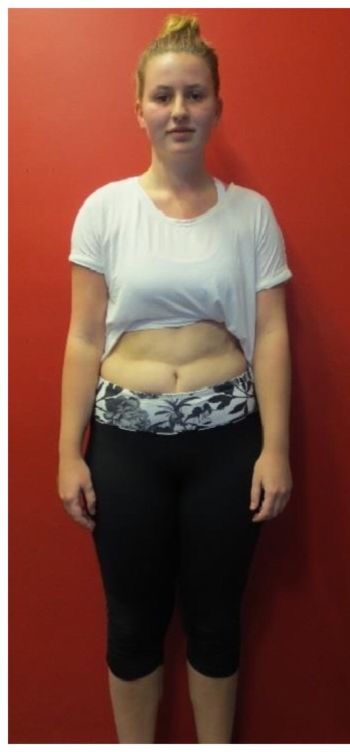 Kaitlyn Dowd (before)