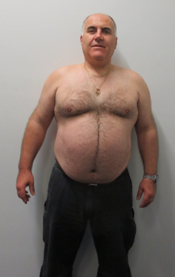 Michael Koutsoukis (before)