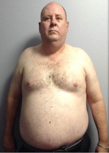 Steven Gargano (before)