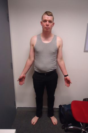 Todd Mackie (before)