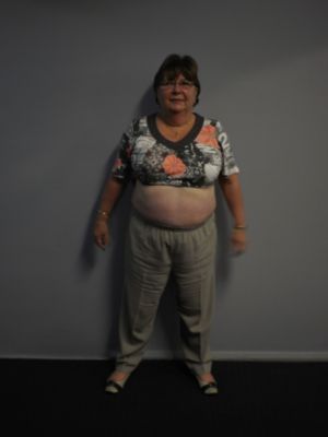 Bernadette Boyd (before)