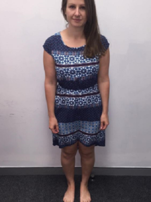 Caitlin Lennon (before)