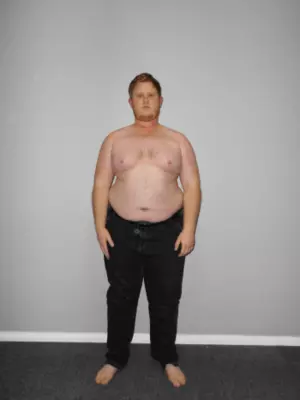 Cameron Williams (before)