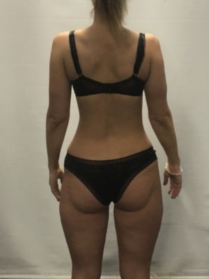 Holly Anderson (after)