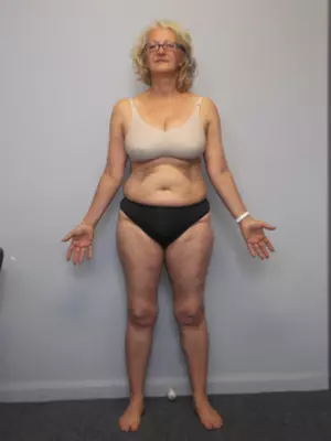 Julie Willis (before)