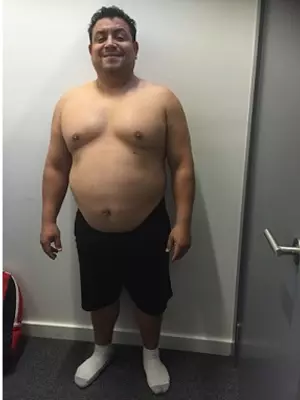 Luis Morales (before)