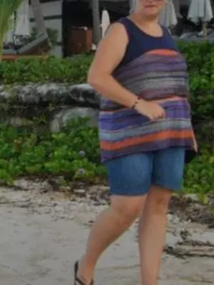Renee Brewer (before)