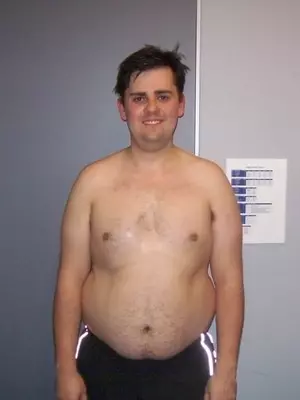 Scott Mathers (before)