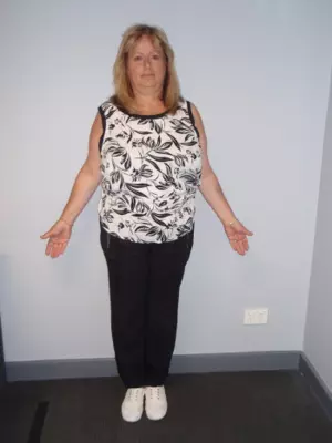 Sue Roth (before)