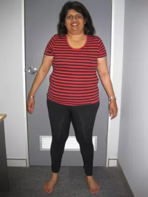 Yushani Lokuge (before)