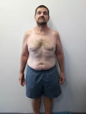 Craig-Before