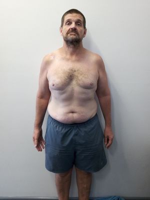 Craig-Before
