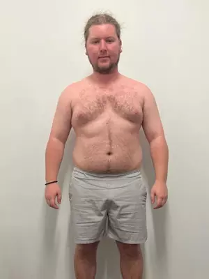 Cam-Before