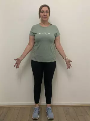 Teressa-Before