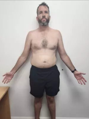 Nick Feil_Caringbah Client Before Vision