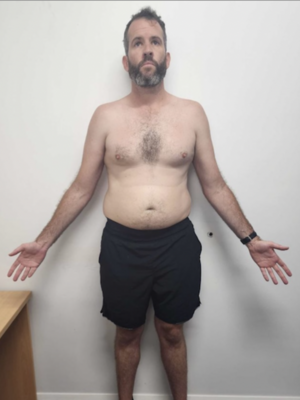 Nick Feil_Caringbah Client Before Vision