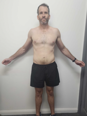 Nick Feil_Caringbah Client After Vision
