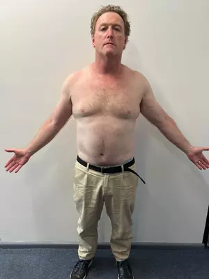 michael-before
