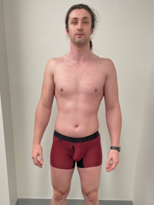 Kyle Philipp St Ives Before Image