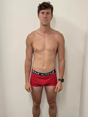 Matthew Briscoe Before Image
