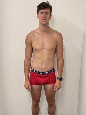 Matthew Briscoe Before Image