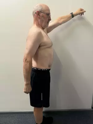 Frank Adler after Vision