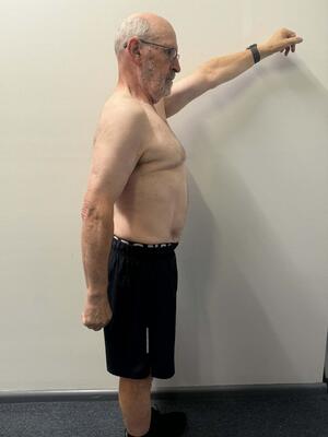 Frank Adler after Vision