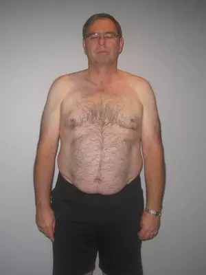 Rob Taylor Before