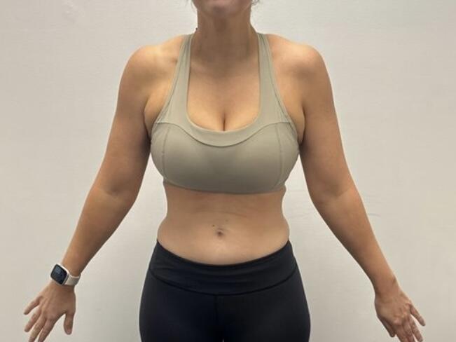 Justine Meges_after