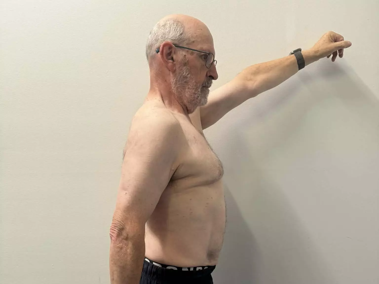 Frank Adler after Vision